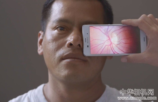 用手机的相机应用和附件实现眼科检查？